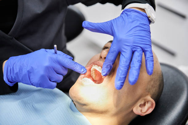 Teeth Whitening in OH