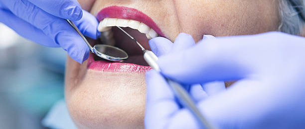 Best Chipped Tooth Repair Near Me  in West Alexandria, OH