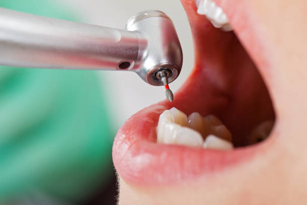 Best Cracked Tooth Emergency Dentist  in West Alexandria, OH